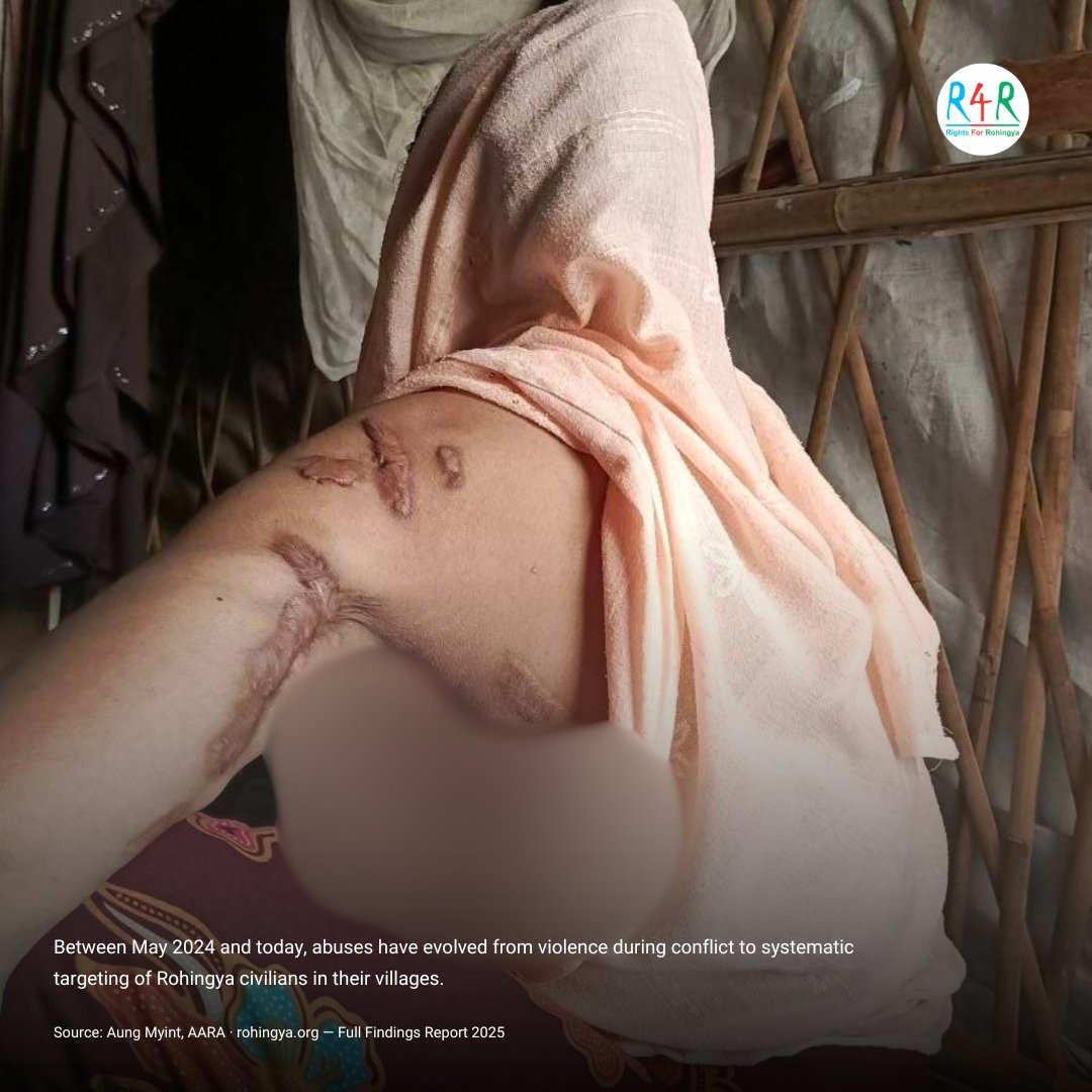 ROHRIngya's tweet photo. Tomorrow is World Refugee Day.

Tonight Arofa Begum will sleep in a refugee camp. Shot six times. Everyone gone except her daughter.

She doesn't need a hashtag. She needs to go home.

What does World Refugee Day actually change? →

#WorldRefugeeDay #Rohingya #RefugeeDay2026 https://t.co/BD6xirgx48