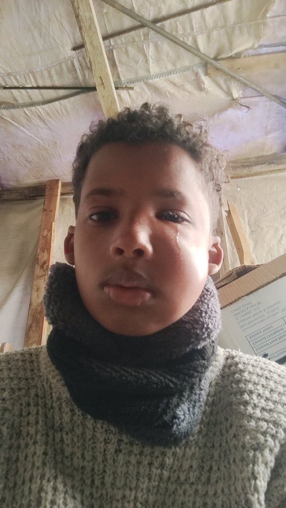 samer_1701's tweet photo. Urgent Medical Appeal: Save Saed’s Sight 
“, my head hurts... there is a popping sound in my eye.” 
With these painful words, 11-year-old saed began a sudden battle for his life. Less than a month ago, saed was a healthy, vibrant child.
https://t.co/fUZRT6IQ3v https://t.co/HaC8sfVQUI