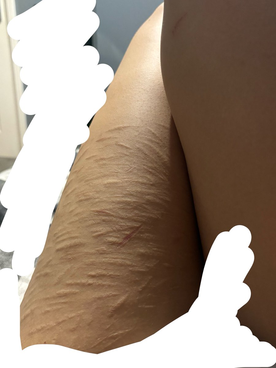 Orbweavrx's tweet photo. Why are they so messy ugh (ignore my fatass legs a levels have had a chokehold on me) #shtwt #shedtwt #ukshtwt #slittwt https://t.co/96PrTcYpnj