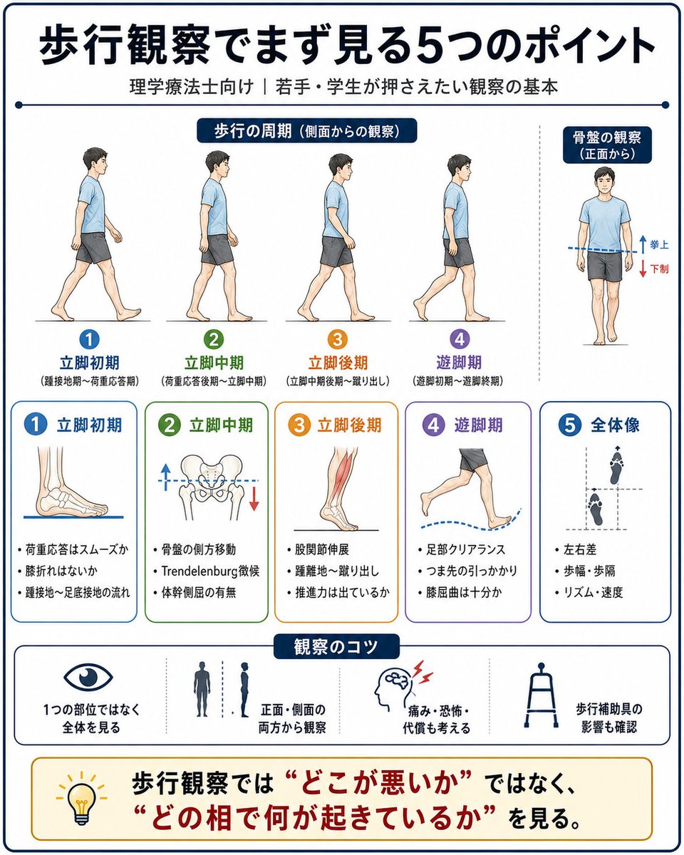 physio_17's tweet photo. 歩行観察で何を見ますか？

各相に分けて考える、前額面・矢状面に分けて考える、各分節に分けて考えると理解しやすいかもしれません

学生の実習中によくバイザーに「どう？」って聞かれたのを思い出します https://t.co/NARI5npXe3