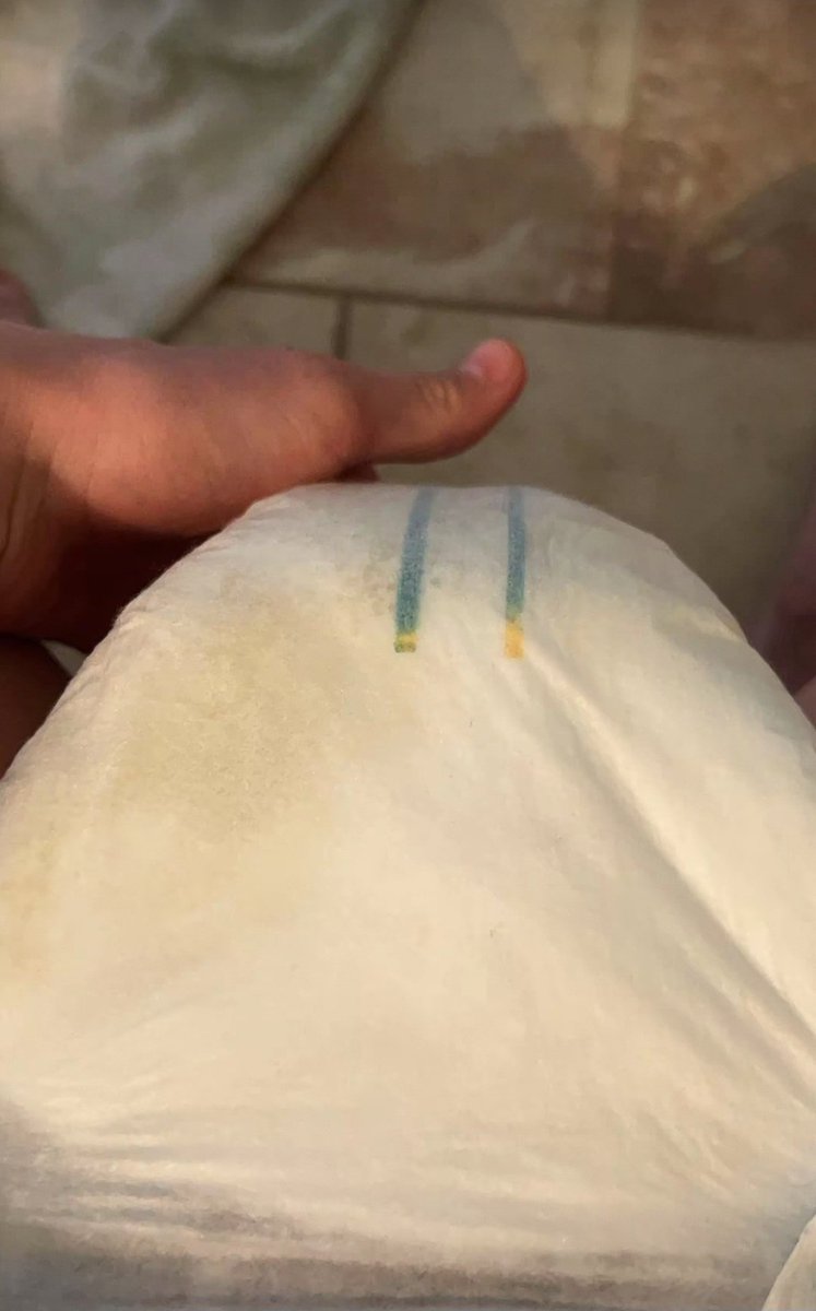 erika_lorita's tweet photo. Efek kebanyakan minum sebelum tidur. Pas tidur gak tahan pengen pipis jadi ngompol deh.
#diaper #abdlindo #abdl #ngompol #popok https://t.co/Jj9DgFaI19
