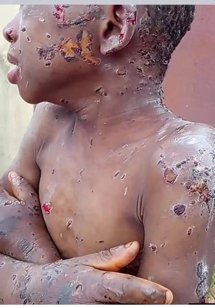 Prince_dc21_'s tweet photo. Take a look at what a human being did to a child who is serving her. 

No one wants to say it but there's this bad stereotype that our Igbo women are creating for themselves everyday and if care is not taken in few years to come nobody will want to do anything with them any more both dating or marriage if nothing is done very urgently. 

With the way things are going currently and with the kind of news and stories we hear everyday about Igbo women I honestly don't see myself ending up with one especially one particularly from Anambra state. 

Check the highest number of feminists it is mostly Igbo women

Check the highest number of people maltreating their house maid it is Igbo women

Check the highest number of women who cheated on their husband it is Igbo women

Check the highest number of young widows who have a successful husband in Nigeria it is Igbo women. 

Check the highest number of divorced young women it is Igbo women. 

Check the highest number of people their husband took a broad and regretted it, it is Igbo women. 

I'm an Igbo man who have sisters that my parents are working so hard to raise them properly to not just become valuable to the society but to also build a home, I wouldn't want a situation where they'll be stereotyped thinking they're the same with others.