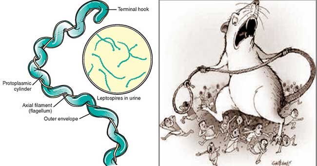 NA_Microbiology's tweet photo. 🦠 BACTERIOLOGY| Leptospira interrogans

Leptospira interrogans is a thin, tightly coiled spirochete responsible for leptospirosis, a zoonotic disease transmitted through contact with water or soil contaminated by infected animal urine. https://t.co/nQZ2UzGwUt