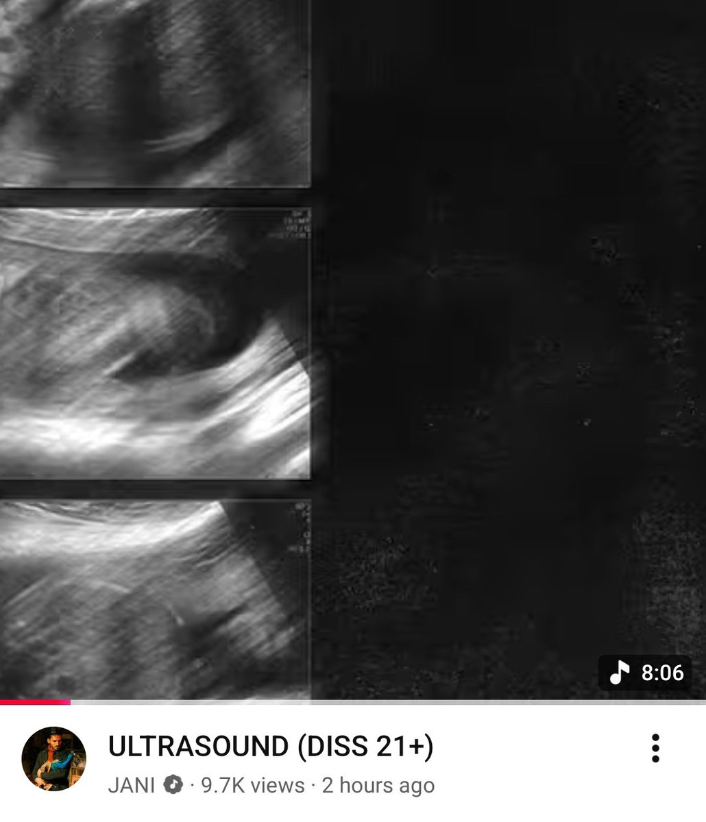 prashantgodaraa's tweet photo. Bhai kyun bna rha hai diss, jab tujhse likha aur gaaya dono hee nhi ho rha hai, isse jyada rhymes mei toh mei meri script pdhta hu, kya hee below average diss tha,I think you should quit music ASAP!! https://t.co/d8r50s7UxI