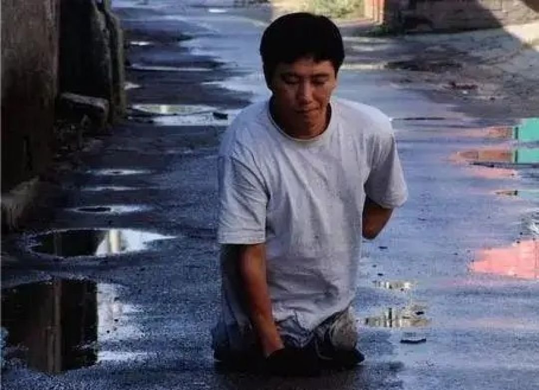 kata_introvert's tweet photo. [Mengerikan] Seorang pria berusia 20 tahun mengambil "gantungan kunci" yang ia temukan di tumpukan salju, tanpa sadar memasukkannya ke dalam sakunya, dan kehilangan kedua kakinya serta lengan kirinya.

🇨🇳 Kisah nyata dari Tiongkok (1996)
- Song Xuewen mengambil rantai berkilauan misterius di tumpukan salju di lokasi konstruksi.

- Karena mengira itu barang yang hilang, ia memasukkannya ke dalam saku celananya, tetapi sebenarnya itu adalah iridium-192, sumber radiasi industri yang sangat berbahaya yang dibiarkan tanpa pengawasan karena kesalahan pengelolaan.

- Hanya dalam beberapa jam, ia terserang mual hebat, dan jaringannya mulai mengalami nekrosis pada tingkat seluler.

- Meskipun ia selamat, ia mengalami tragedi besar, kehilangan kedua kakinya, lengan kirinya, dan sebagian besar jari di tangan kanannya.

- Setelah itu, ia menulis otobiografinya dengan jari yang tersisa dan bahkan memerankan dirinya sendiri dalam sebuah film, menunjukkan semangat pantang menyerah yang luar biasa, tetapi ia meninggal dunia pada tahun 2019 pada usia 43 tahun.

Sumber : https://t.co/Fn7FfIg3cG
