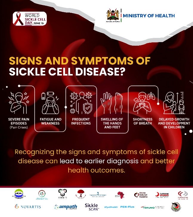 MOH_Kenya's tweet photo. Signs and Symptoms 

Recognizing the signs and symptoms of sickle cell disease can lead to earlier diagnosis and better health outcomes.
Common symptoms include:

• Severe pain episodes (pain crises)
• Fatigue and weakness
• Frequent infections
• Swelling of the hands and feet
• Shortness of breath
• Delayed growth and development in children

If you or someone you know experiences these symptoms, seek medical advice for proper evaluation and care. Early diagnosis and consistent treatment can significantly improve quality of life.
Awareness saves lives. Share this message and help spread the facts about sickle cell disease.
#worldsicklecellday #sicklecellawareness #tuongeencds #knowyourstatus #healthawareness
 
￼