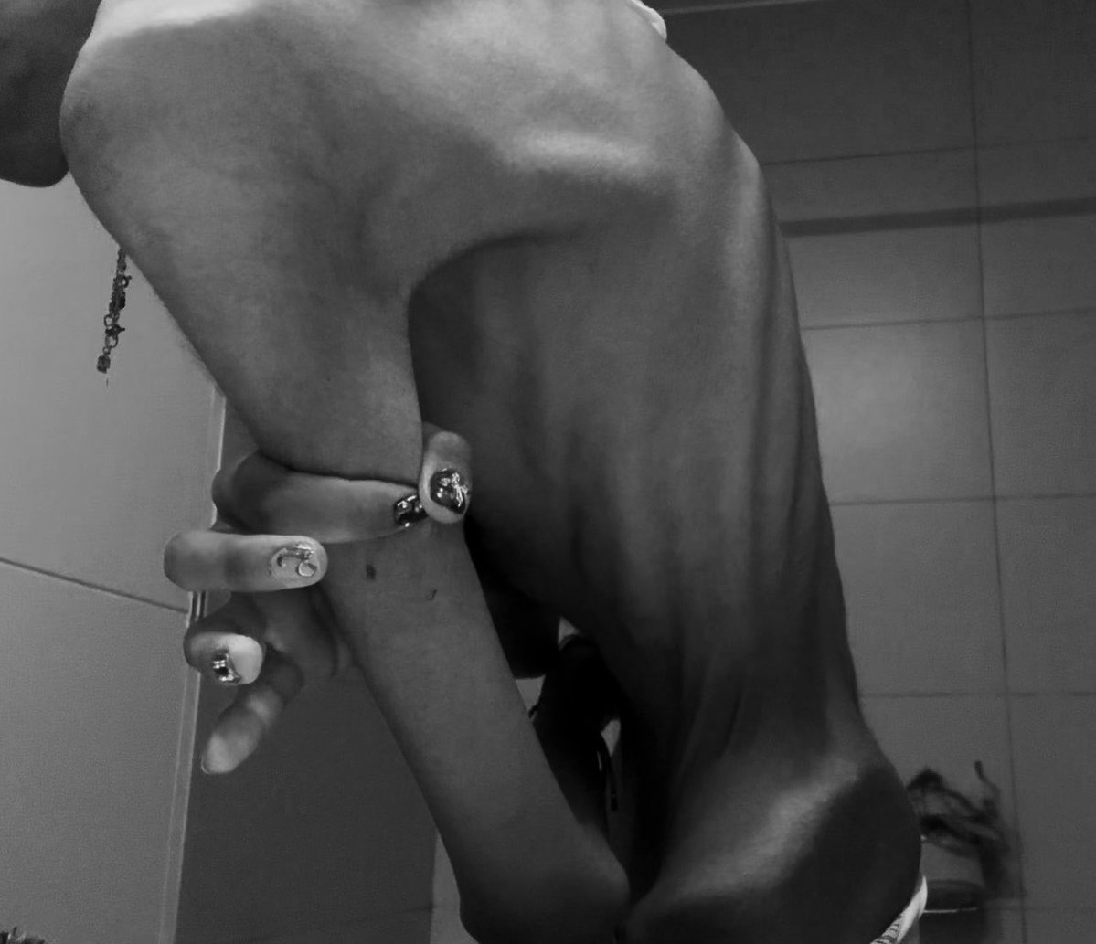 treewer3's tweet photo. This morning I took this picture. Reminder that im still fat :( i really wanna d1e #edtwtㅤ #ana #wl https://t.co/fhvzCwZZSX