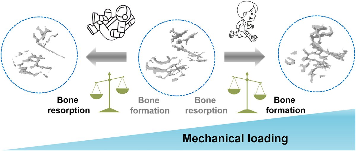 DerekGriffin86's tweet photo. A great overview of the mechanobiology of bone.
*High strain magnitude/rates beneficial (e.g. jumping, heavy resistance with max intent).
*Short inter-rep recovery to re-establish fluid dynamics.
*Relative few loading cycles (given cellular saturation).
https://t.co/KemHEoq3mD https://t.co/xuGUuvHCrb