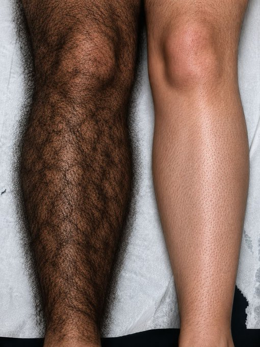 MZora0419's tweet photo. Señales que se asocian con niveles altos de testosterona.  

1. Mucho vello corporal, (especialmente en piernas). https://t.co/8GdbpRcZb1