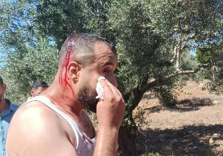 WAFANewsEnglish's tweet photo. Three Palestinians injured in Israeli colonist attack in Salfit

https://t.co/ndcGJ5a5R4 https://t.co/57xHaK3rxM