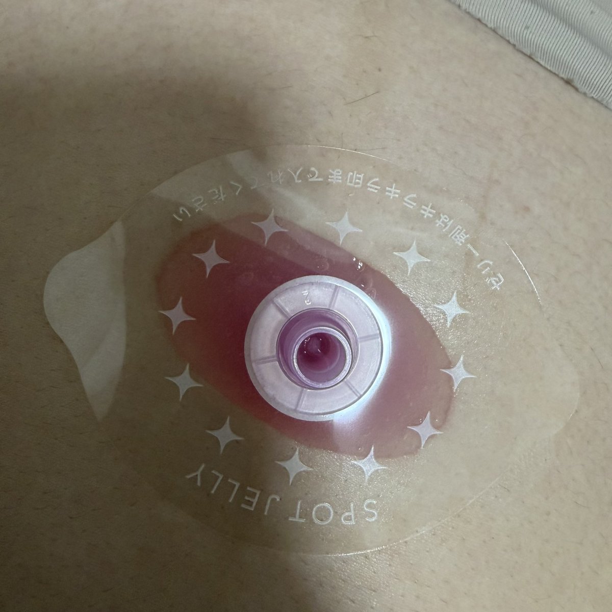 hanakonohanako8's tweet photo. 花王さまからいただきました！

液を混ぜるのもプニプニするだけでできるし、
つけて15分放置するだけで綺麗になるのが嬉しい！

自分でケアするの大変だから
手軽にできるのが嬉しい！

#モニター企画_SPOTJELLYへそごまパック https://t.co/DAYMHzjjYr