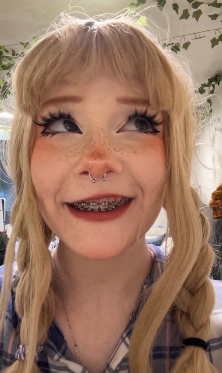 kittyshelbypng's tweet photo. Braceface >.< https://t.co/zTYZSsNWHa