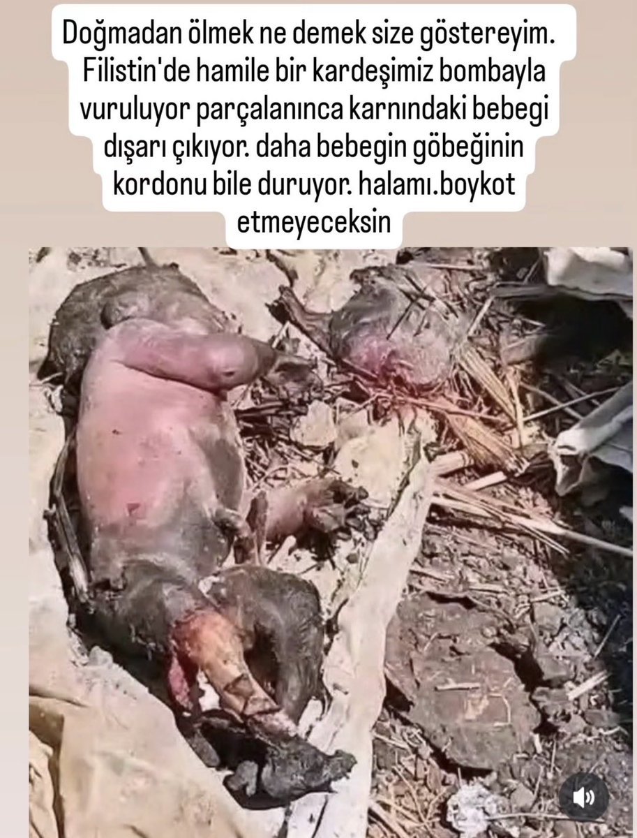 rfanKuyumcu2's tweet photo. .İslam ahlakı/kültürü ile dolmayan zihinler
Keyfi batıl anlayışlarla dolar...
#Anneleri
#GazzedeZulümArşaDayandı https://t.co/Wkzk3k7TJl