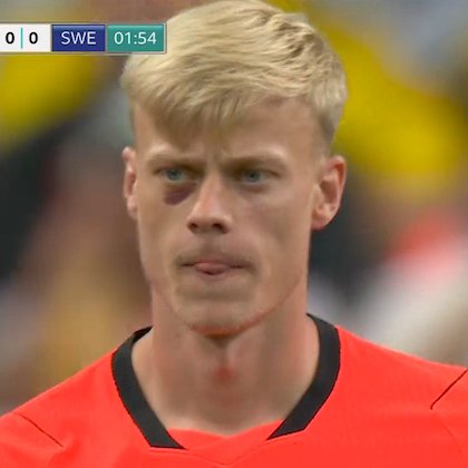 TouchlineX's tweet photo. 📸 - Jan Paul van Hecke during the game.

He got a hit to the eye in the previous game. https://t.co/ZZ0gLJYzwF