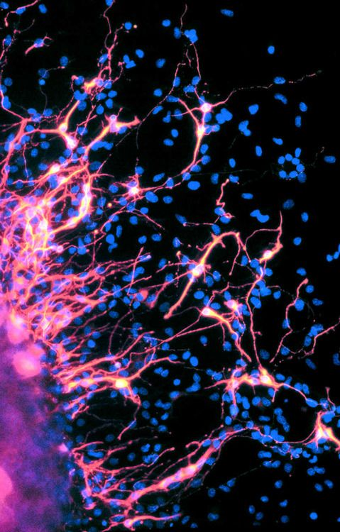 latestincosmos's tweet photo. JUST IN🚨: Neurology says consciousness may not come from neurons, but from a hidden brain pathway where thoughts move at the speed of light. https://t.co/lefwSZPu2f