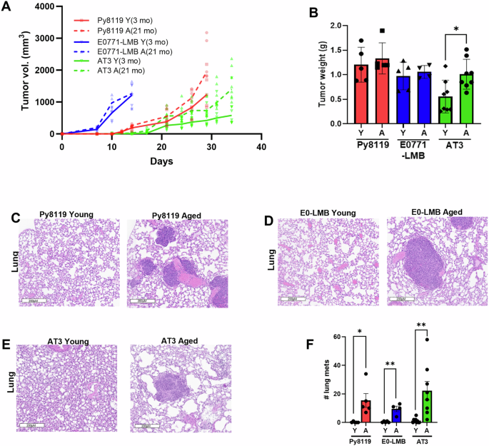 CommsBio's tweet photo. Aging promotes a RAGE-dependent increase in breast cancer metastasis: Communications Biology, Published online: 15 May 2026; doi:10.1038/s42003-026-10022-4RAGE activation in aged hosts amplifies inflammatory remodeling of the tumor microenvironment and… https://t.co/iySB2HbW9E https://t.co/mFj8OHlWGJ