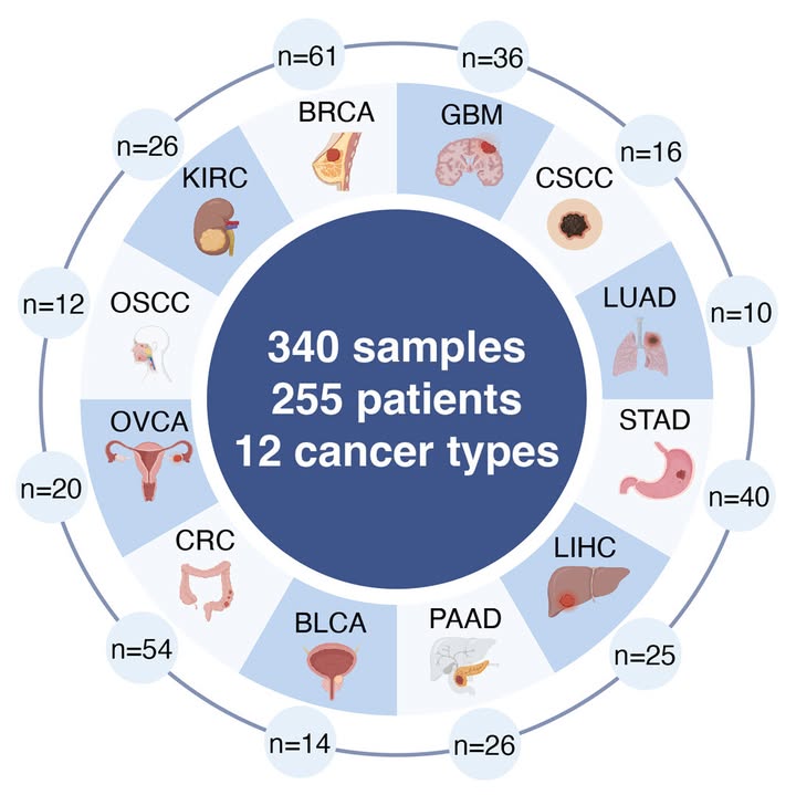 ScienceMagazine's tweet photo. Tertiary lymphoid structures (TLSs) form local immune hubs inside tumors, but they are diverse and not all are equally functional. 

In a new Science study, researchers built a pan-cancer atlas and developed an #AI–based framework to detect and characterize TLSs in human tumors. 

The study provides insights into TLS biology and may offer a path toward integrating TLS features into future clinical trials. 

Learn more: https://t.co/NlkZQDfTj4