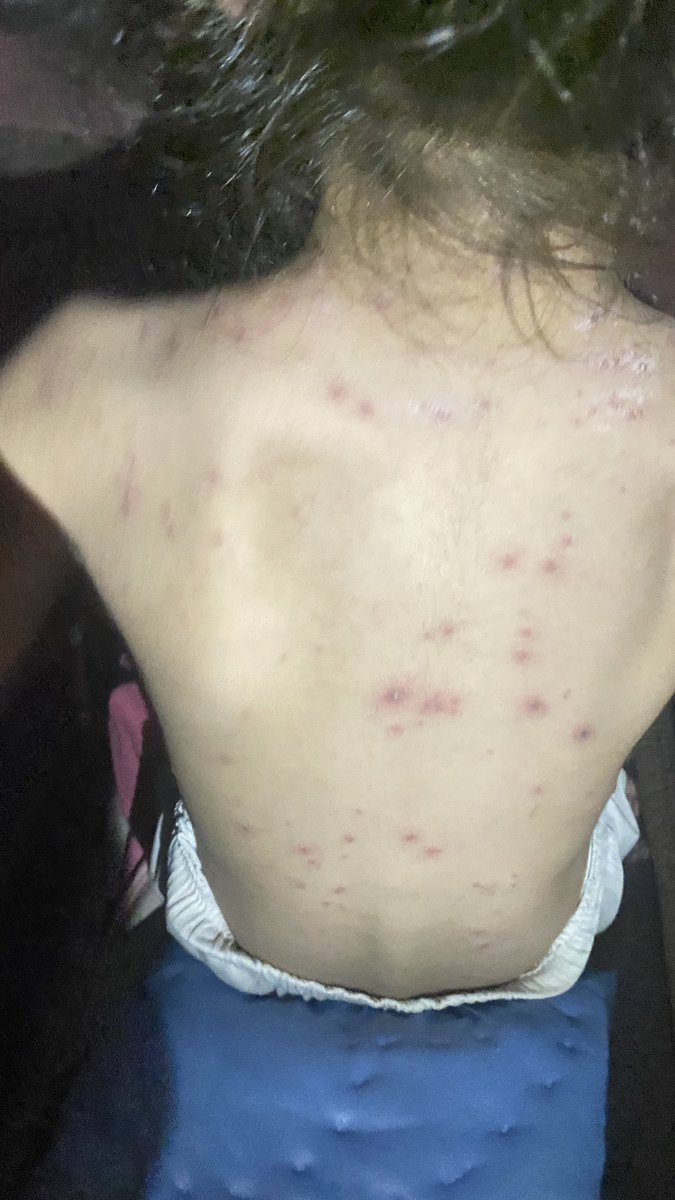 AtallaAbed's tweet photo. I BEG YOU

Stop please

My child is dying

Don't ignore

beg you

I need MEDICINE

beg you

Help me

I need MEDICINE 

I need MEDICINE

I need MEDICINE

Help me

I need MEDICINE

I need MEDICINE

I need MEDICINE

I need MEDICINE

I need MEDICINE

Help me

https://t.co/fRP5iKKMfu https://t.co/dtKXPihhcD