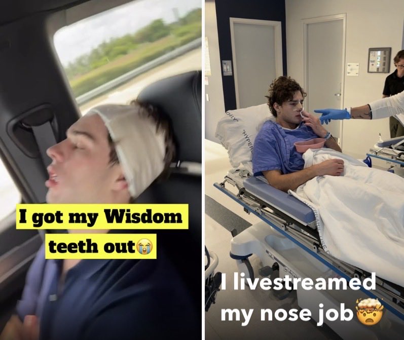 Wengles's tweet photo. I livestreamed having my wisdom teeth put back in. https://t.co/eqLijMhegP