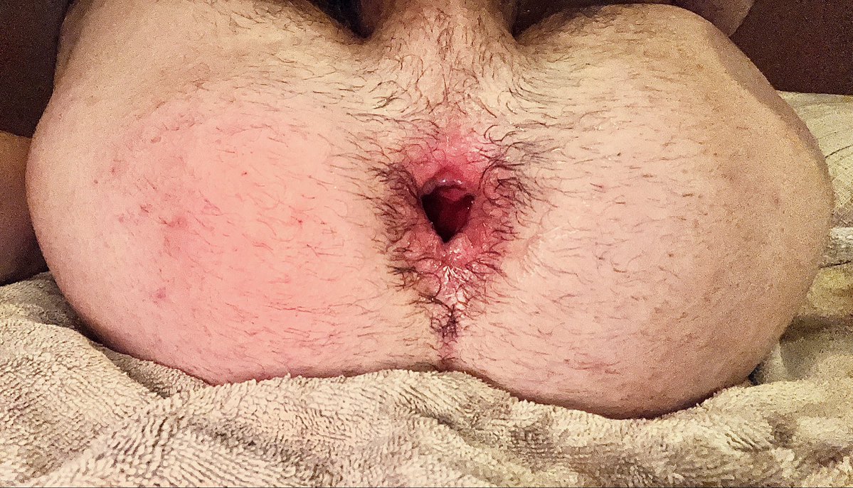 Fistingrookie's tweet photo. Tiny but cool gape https://t.co/bkf7QiKlWm