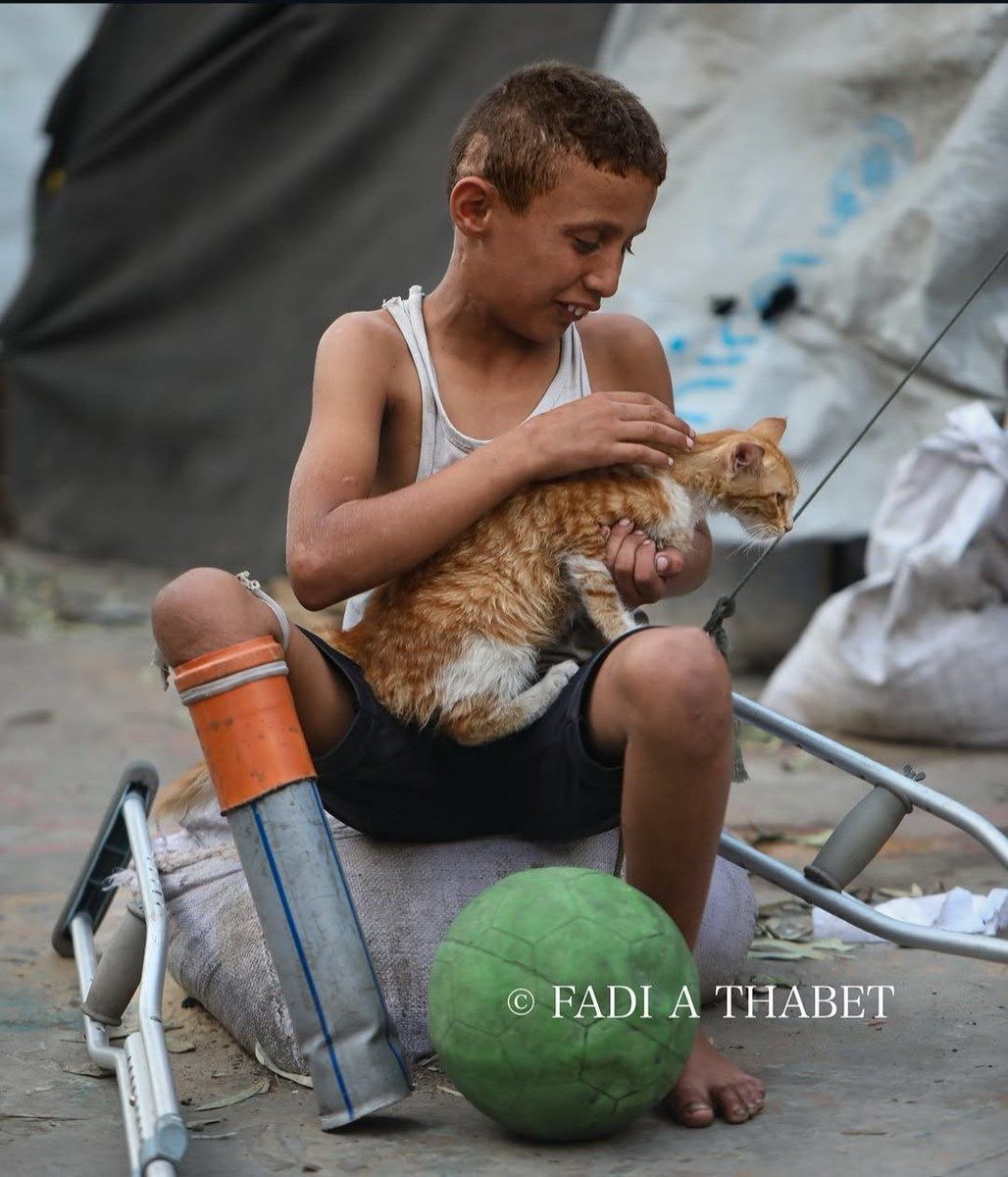 QudsNen's tweet photo. A Palestinian child, who lost a legو in the Israeli war on Gaza. is using a makeshift plastic pipe in place of a prosthetic limb amid shortages in the Gaza Strip due to the ongoing Usfaeli blockade. https://t.co/n0daN5REHH