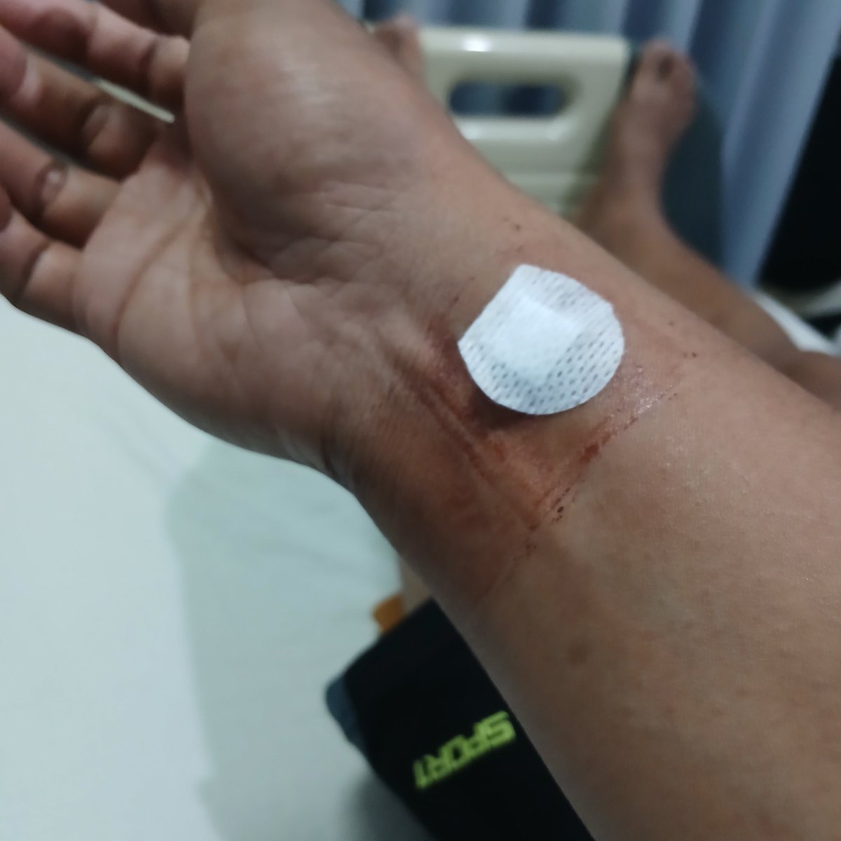 _eh16's tweet photo. @CorpusAlienumm Saya penyumbatan 30%. Alamak sakitnya dada kiri ini. https://t.co/gc1LMeSM0j