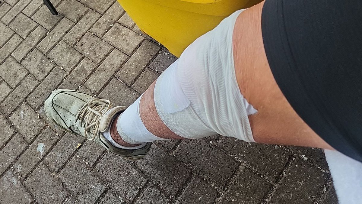 roydaleme's tweet photo. I’m still single because I have one leg https://t.co/NnUCkUuoE9