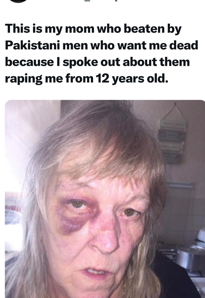 FaikeJstce's tweet photo. #Seems to me like PM @Keir_Starmer is ONLY outraged when attackers r
#White natives like him, &amp;
@Heccles94:(! NEVER if 
#Muslms 4 sure, Hns 
@Nigel_Farage @reformparty_uk 
@BasilTheGreat @RupertLowe10 @RestoreBritain @benhabib6 @TheBritishIntel 
@mehdirhasan 
@elonmusk!
God❤️ALL! https://t.co/iFi87eOFvp