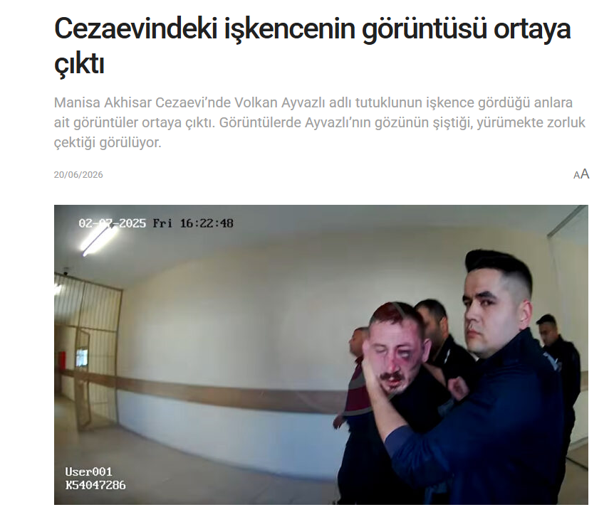 ademyarslan's tweet photo. Washington DC'ye gelip "Türkiye'de işkence yok" diyen Metin Feyzioğlu ve bazı CHP'lilere izletsinler... https://t.co/Y2m1zR4VY4