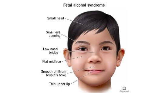 scharlettemtz's tweet photo. Ahora qué ladran mis síndromes alcohólicos fetales? 

Aquí unas fotitos de ellos 🤗

Encuentren sus diferencias 🤣

Están igualitoooos! 

Lógico, los gestaron padres alcohólicos! https://t.co/KeC2mPFjS1
