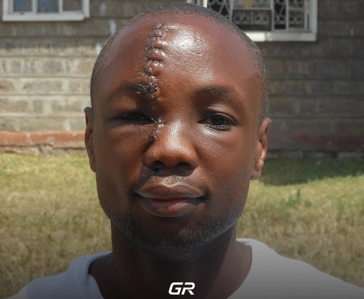 clad254's tweet photo. A 24-year-old man fought off six armed men with a hammer to protect 37 sleeping orphans at faraja children's home in kenya. This is anthony omari https://t.co/83yhbLkPGH
