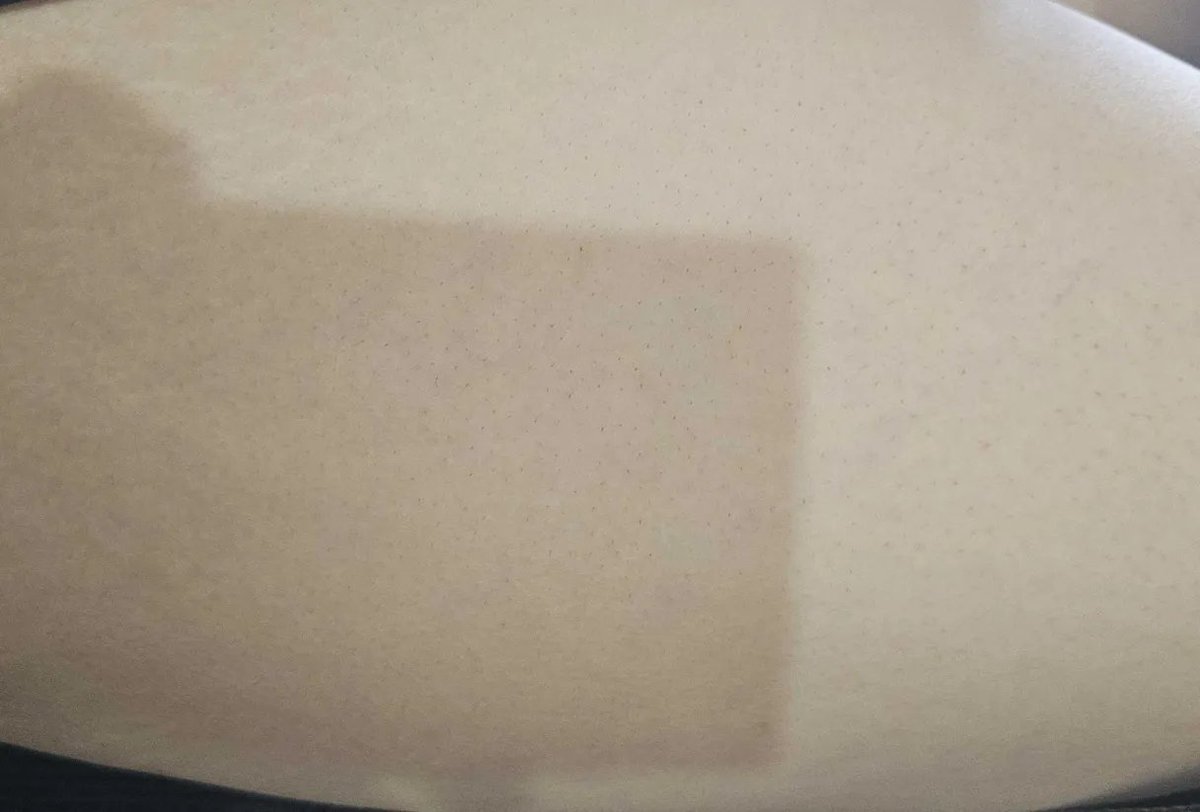 HatsuneArmy64's tweet photo. @piracy_cat Exfoliating and moisturizing with a cream that contains at least 10% UREA.
Have played around with it but that's what works for me.
I use this cream and this is how my skin looks like a day after shaving https://t.co/58f0TOmzZv