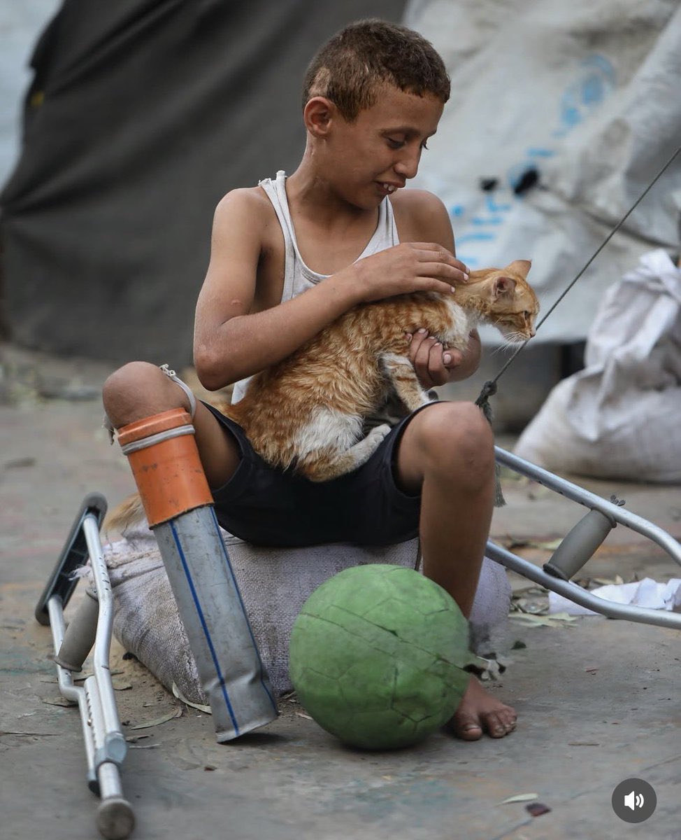 mohammedIhysse's tweet photo. This child was pulled from the rubble of his home after it was bombed.

Every member of his family was killed, and he was the only survivor.

He lost his leg, but he did not lose his desire to live.

He made himself a simple prosthetic from a plastic water pipe, then returned to playing football with the other children. 💔⚽

Whenever I see this child, I realize that the children of Gaza possess a strength that is impossible to describe.

They wake up to loss, live through pain, and yet they still search for a reason to smile and a small space to play.

Look at how Gaza’s children hold on to life despite everything…

Despite their wounds, despite their loss, and despite the fact that war has taken from them far more than any child should ever have to lose.