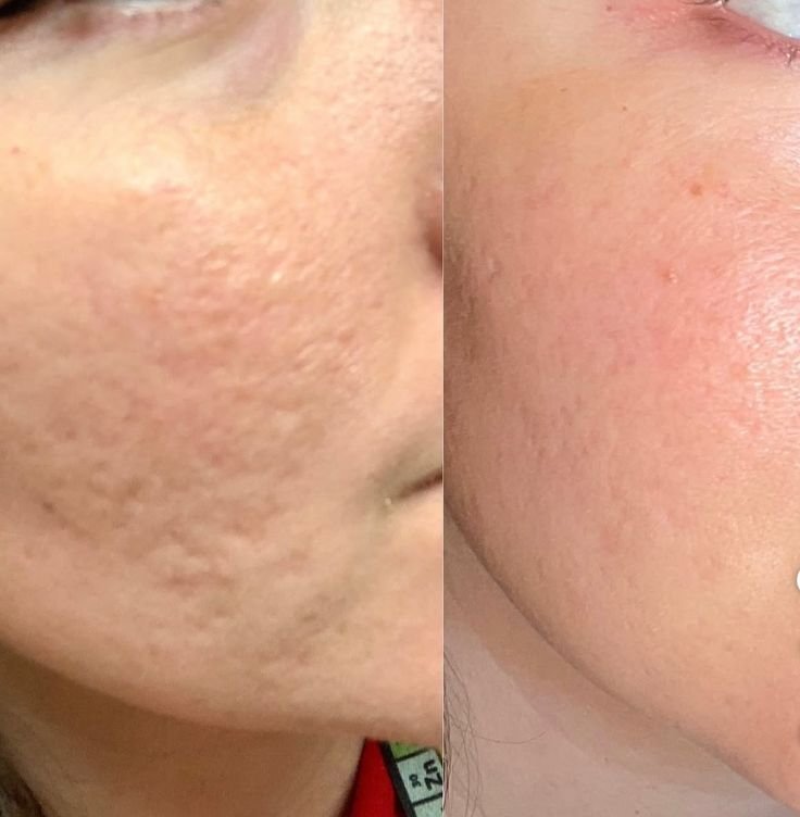 kafklore's tweet photo. tenho pena de quem é refém de procedimento estético sendo que em alguns meses o retinol muda até o seu dna se deixar https://t.co/UtvoOHGK1O