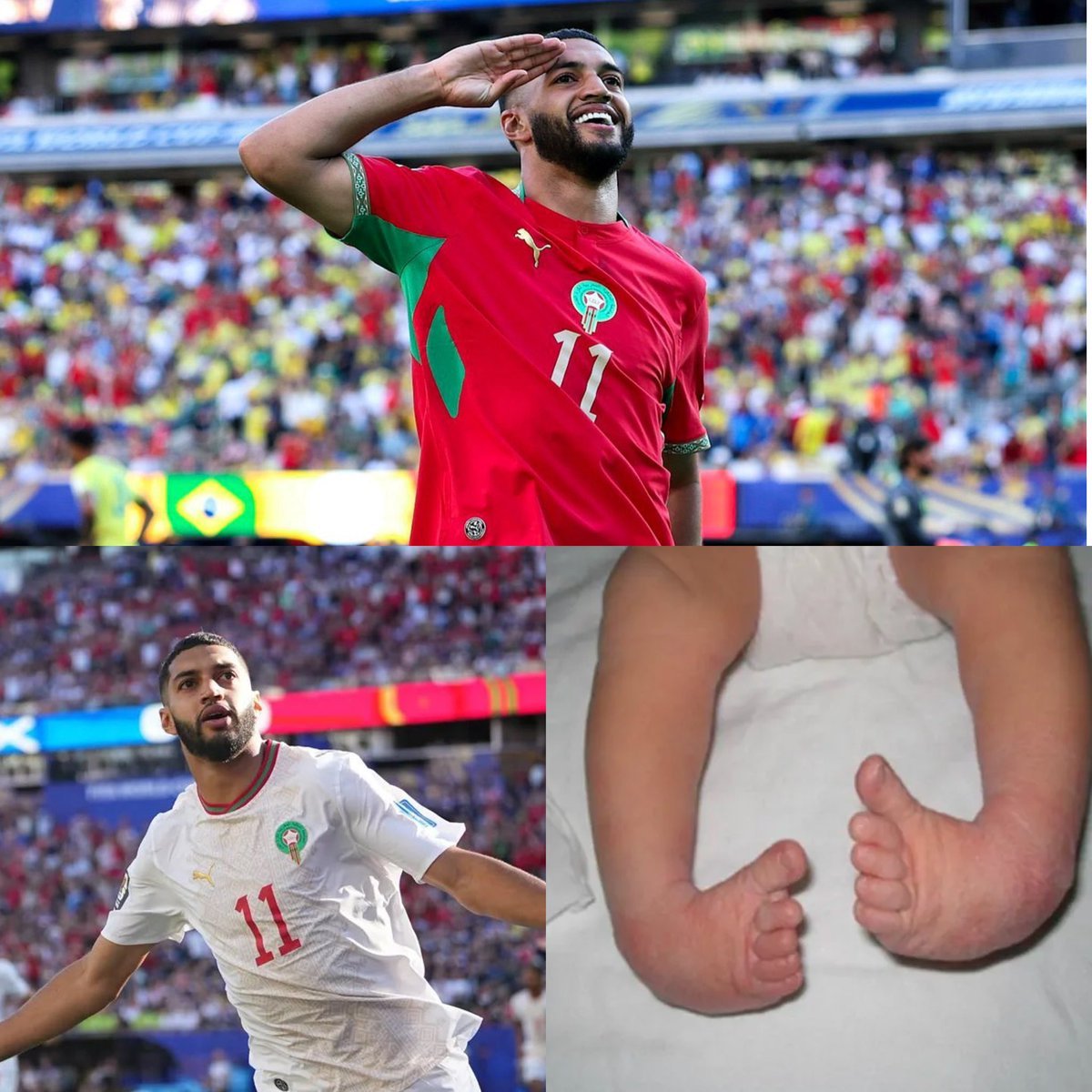 kwekuedilson's tweet photo. Ismael Saibari... and the story of the great transformation.

-At the age of two, the Morocco national team star suffered from a foot condition (in-toeing since birth), and doctors said it would be difficult for him to ever walk normally again. https://t.co/VP1xdc9py5