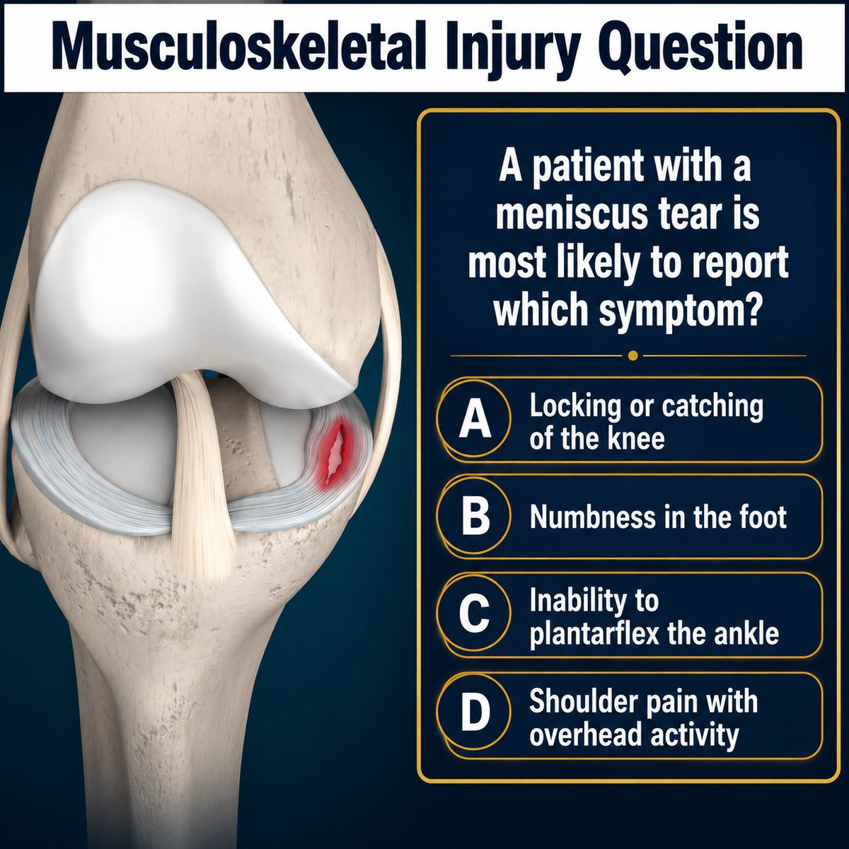 MedEd_Cases's tweet photo. 🦵 Musculoskeletal Injury Question
A patient with a meniscus tear is most likely to report which symptom?
A. Locking or catching of the knee
B. Numbness in the foot
C. Inability to plantarflex the ankle
D. Shoulder pain with overhead activity
💬 Drop your answer in the comments before looking it up!
Full explanation on https://t.co/Mylo49Wy93.
#Orthopedics #SportsMedicine #KneePain
#PhysicalTherapy #Anatomy