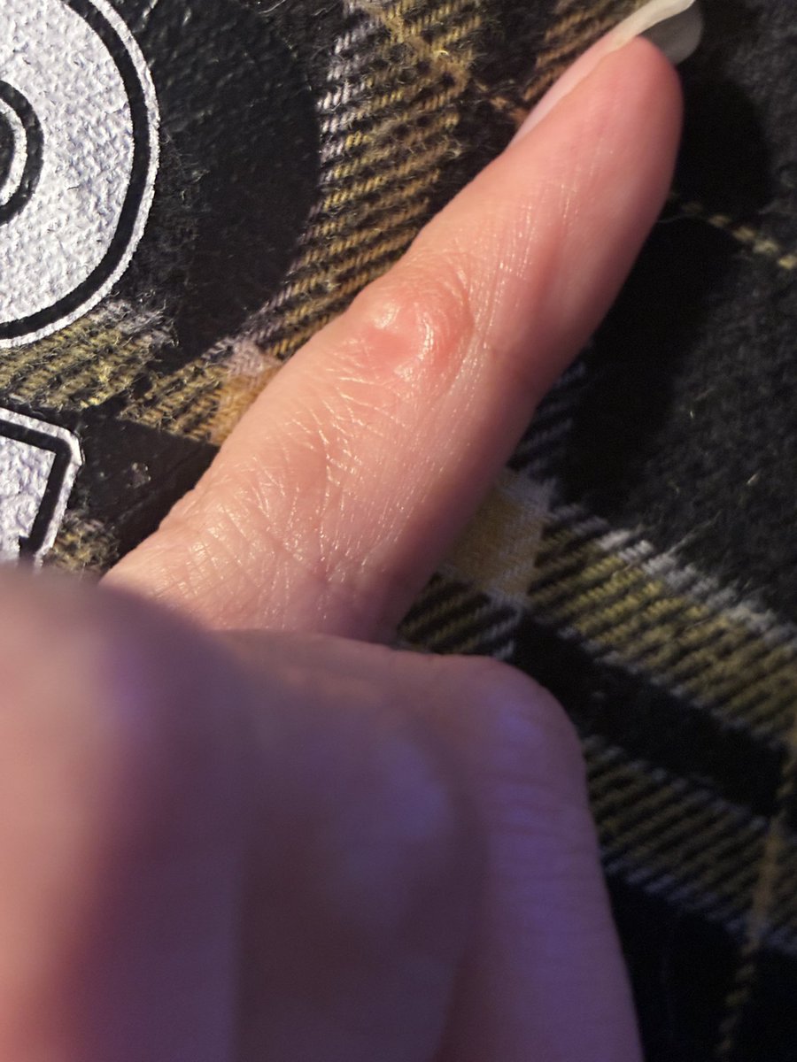 TearsOfInk_'s tweet photo. Y'all mean to me THERE'S A PINKY PILLOW 😭and my pinky got the short end of the stick all those years with the blisters and indentation 😭😭😭 https://t.co/2PA6j2tY5H