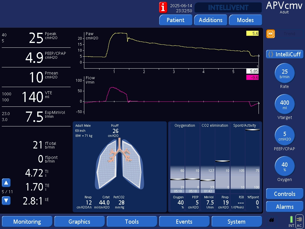 DanRozenbaum's tweet photo. Detecting leaks on waveforms (3/3):

We saw that a sharp reset in the volume-time curve and an insp hold Paw that doesn’t plateau are signs of leaks.

Click below to see a third waveform sign of leaks and how we treated last post’s case of a tracheal pleural fistula!