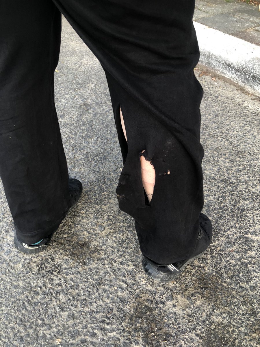 BulutGulcuN's tweet photo. Takipçi mesajı: Bursa Orhaneli ‘nde bu gün bir köpek bir kadına saldırmış, vatandaşlar yetişmiş kurtarmış. Haberiniz bile olmadı…
#başıboşköpekterörü https://t.co/PVE26wfVAp