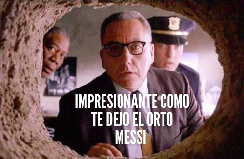 Harry__Porker's tweet photo. @AntiArgensimio Mechico culo roto https://t.co/NwvKYDn5z3