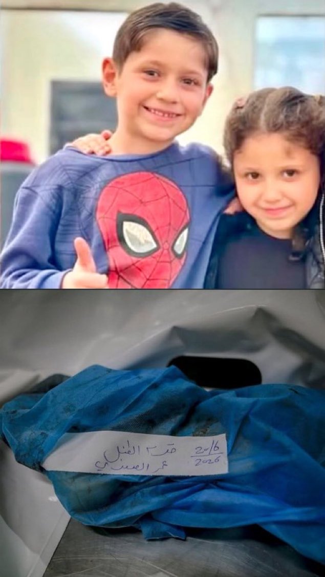 intuitivemais's tweet photo. 🚨La jambe de Omar, âgé de 9 ans, a été amputée lors d'une frappe israélienne sur sa maison à Gaza ce matin. Sa sœur Zeina (4 ans) et sa sœur Lana (11 ans), ainsi que leur père, ont été tués. Leur mère est dans un état critique. https://t.co/e3Dcv9vEI6