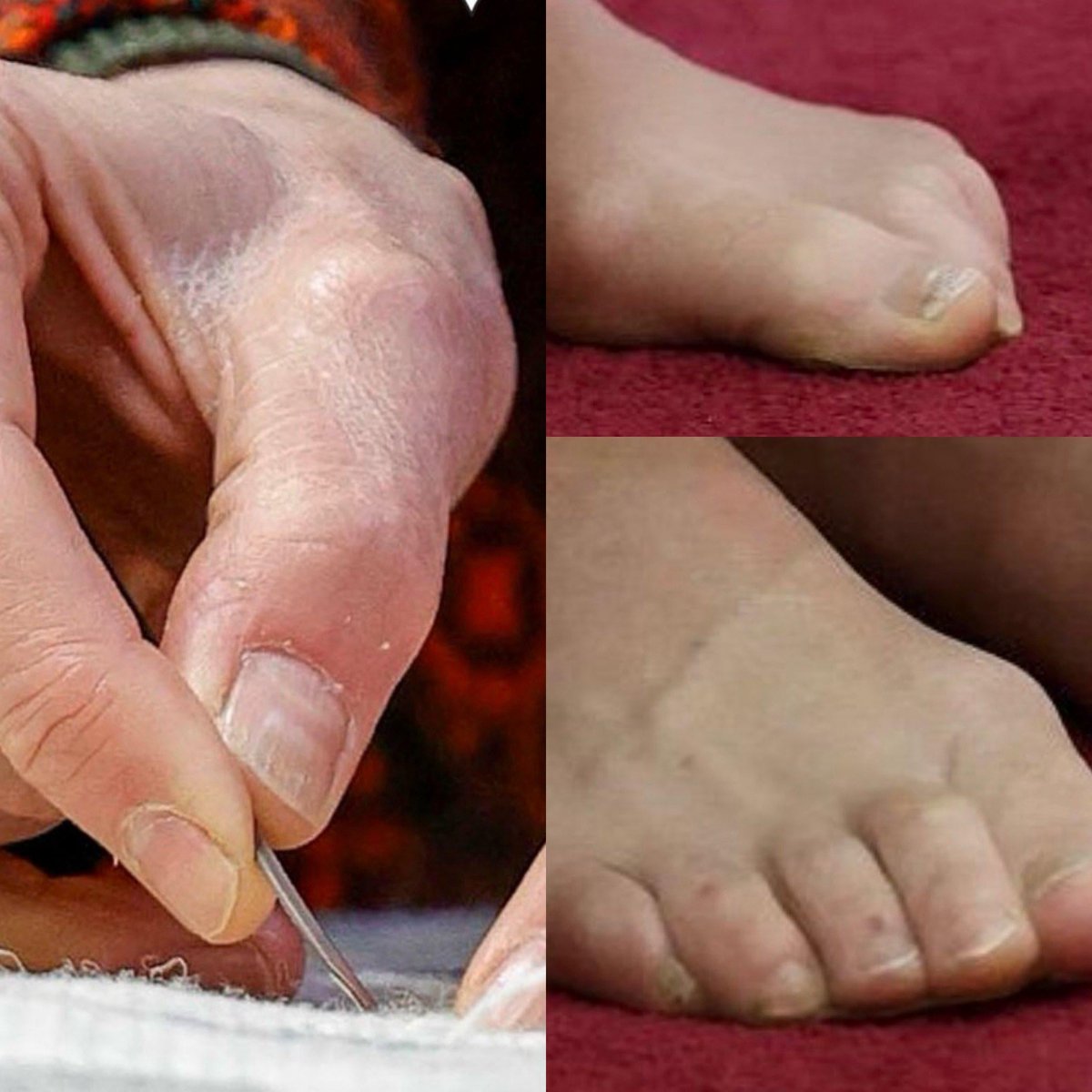 EAPoeEstNe19jan's tweet photo. @andrews_ange #khate should be specific when adding her 2p. The #SkeletalRacist knows whom she would exclude from receiving love. #Mumblina’s too busy playing #DrinkingGames, #EnjoyingNature &amp; pretending she underwent #KancerTreatment to even care for her feet AND get sunshades😎 for her kids! https://t.co/jckZhmVxYf