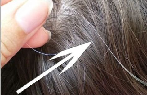 arusheehee's tweet photo. Hey @grok  plucking one white hair can cause multiple white hairs? https://t.co/3r2LsmhoK7