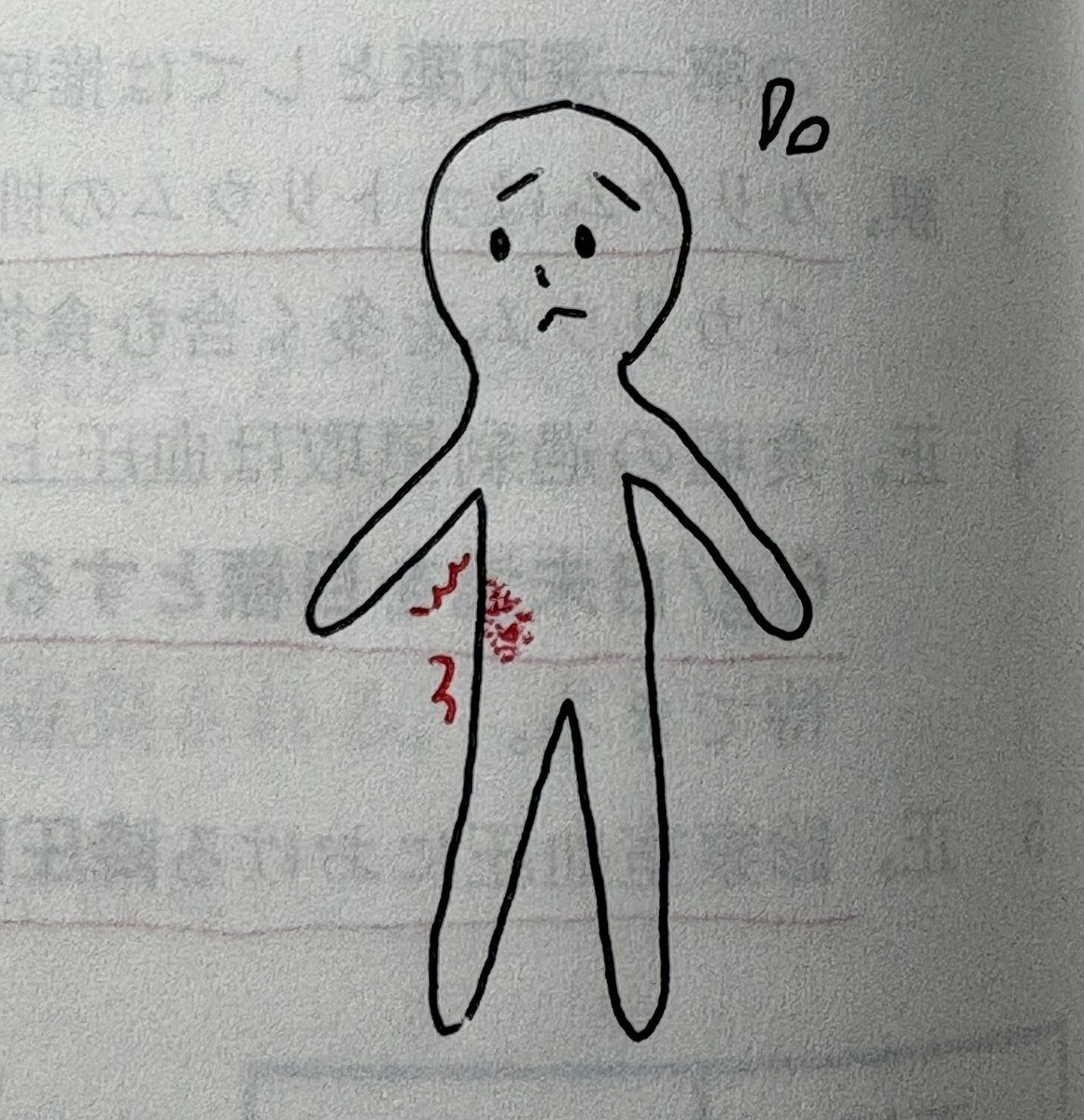 matanchupham's tweet photo. 帯状疱疹の。絵。 https://t.co/Otv7GAha2H