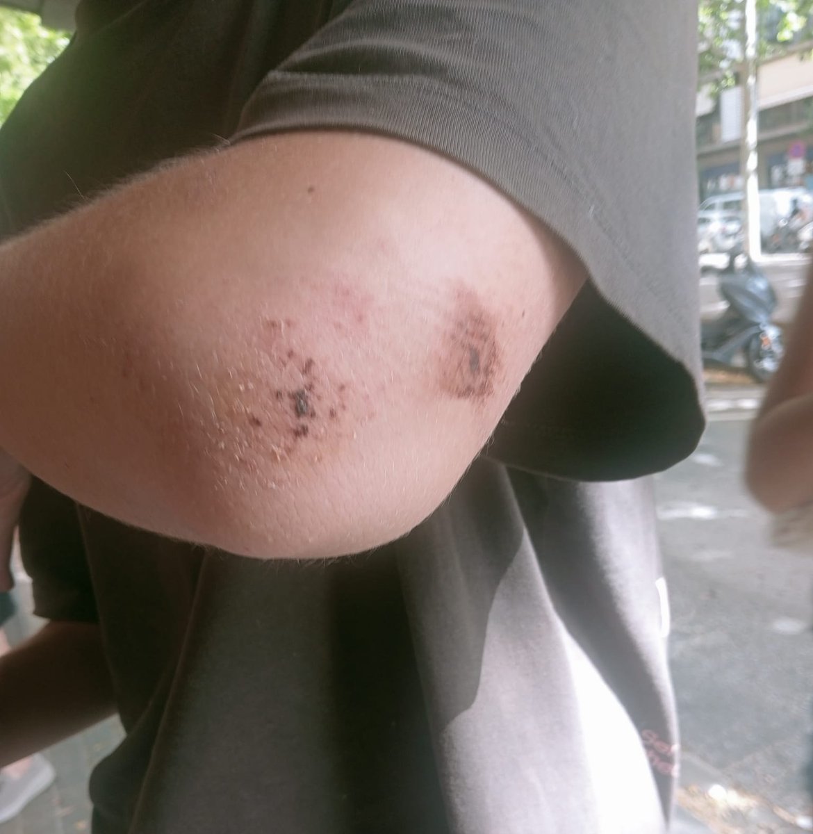 CambrolleMar's tweet photo. 🌈 STOP LGTBIFOBIA 🏳️‍⚧️
En la madrugada del 21 de junio en Mataró, un adolescente de 16 años ha recibido una paliza por un grupo de jóvenes al grito: "maricón de mierda". 
Exigimos urgentemente a @desdelamoncloa frenar los discursos de odio, para ello sin más dilación ha de ser nombrado el órgano sancionador que prevé la Ley Trans y Derechos LGTBI, en vigor desde hace tres años. Frenar la impunidad con la que circulan discursos de odio en las plataformas digitales, es una prioridad. 
La ultraderecha, los movimientos transodiantes y la inacción del Gobierno, son el cóctel responsable de este inadmisible aumento de delitos de odio hacia el colectivo LGTBIQA+. 
Basta, YA !! 
La @PlataformaTrans ha derivado el caso al @Observatori_cat para que preste a la víctima y su familia apoyo jurídico y psicológico.