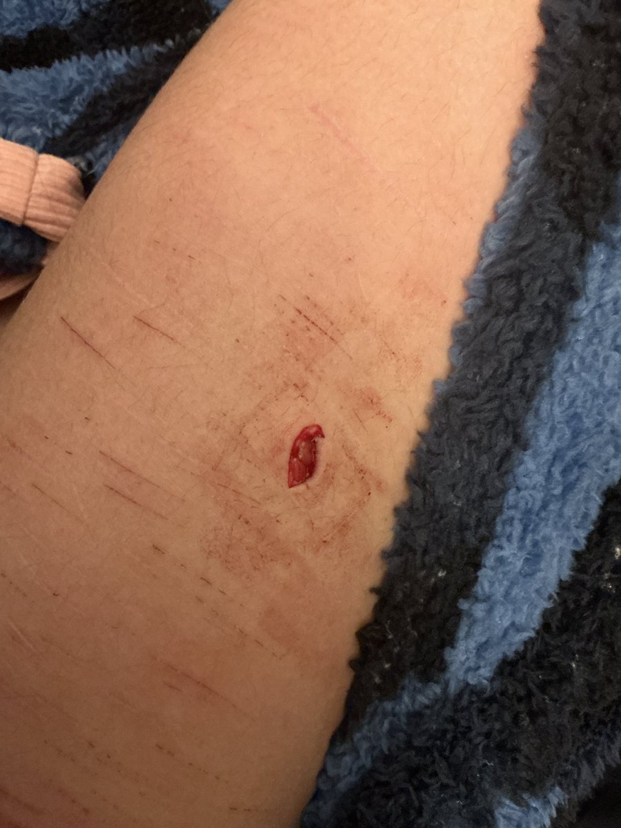 nomnomsora's tweet photo. here it is its super small like 1cm long but yeah ouchi first beansz 
ALL FAKE SFX!! MADE BY AI!! https://t.co/L3YpLVDq3G