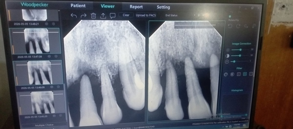 lighthouse201's tweet photo. @Wizarab10 1.86million to do dental surgery for a very hardworking, faithful, and consistent friend who can't treat an aggressive periodontis infection. Pictures below https://t.co/eqzQ9ujCpO