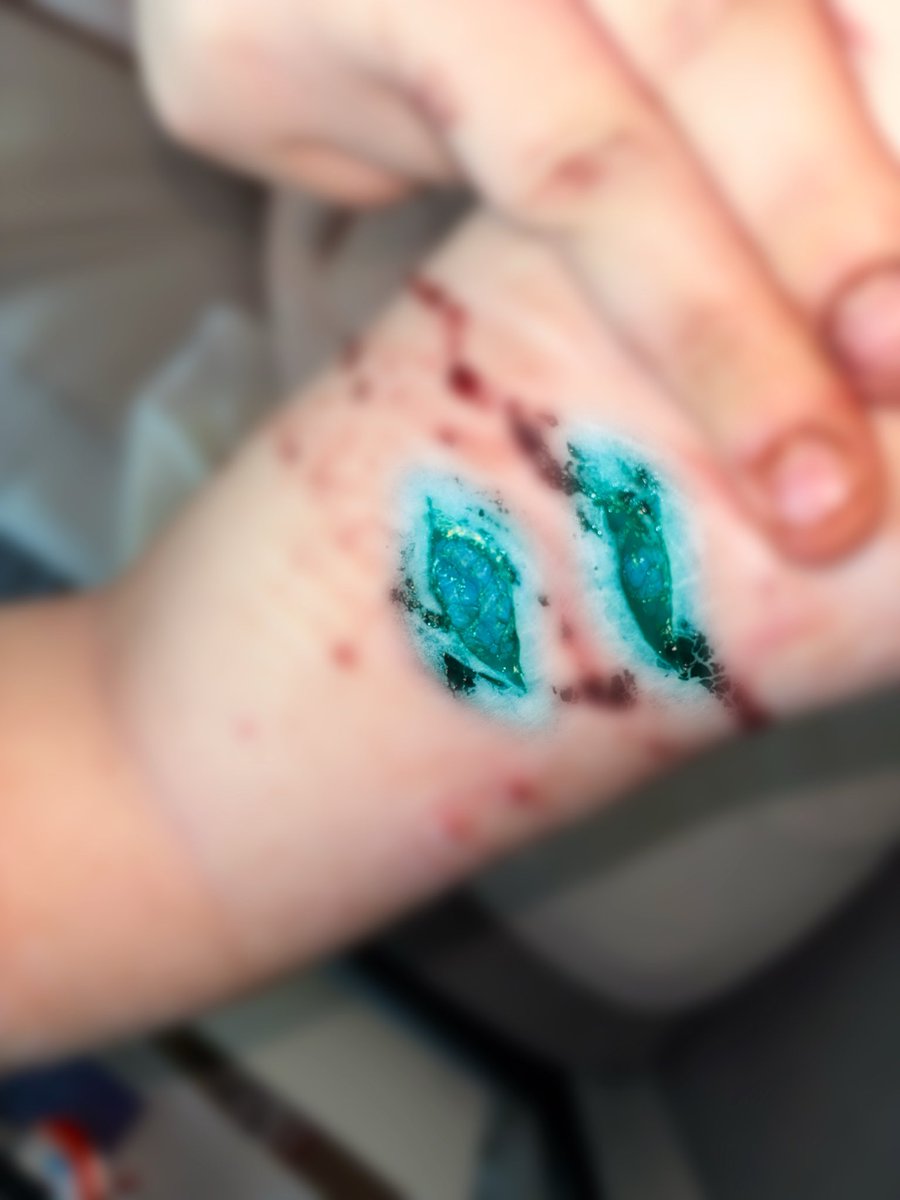 Roryslitting's tweet photo. The other ones i did, which are all also SFX makeup touched up by AI!!
#988twt #slittwt #slittertwitter #shedtwt #sledtwt 🔪twt 🪒twt 🩸twt 🏚️twt https://t.co/qkaLK9TQHh