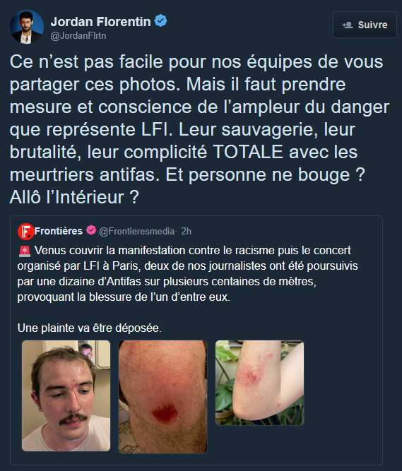 Kmeuh's tweet photo. miskine le boug il est tombé sur le goudron comme une giga merde ça devient une agression de l'esstraim gôche en diret https://t.co/PTA9eEqZIF