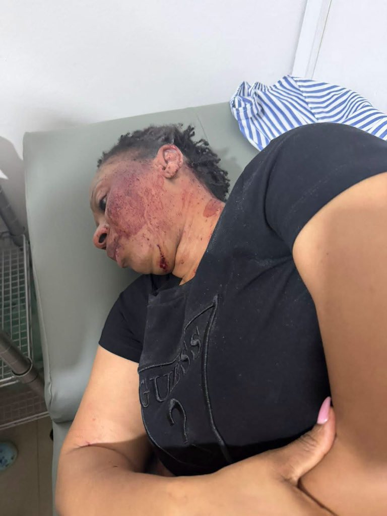 GHANA_PRESS1's tweet photo. Hon. John Dumelo pays a hospital visit to Adwoa Safo after reports emerged that she was allegedly shot. 🙏🏽💔#ghanapress https://t.co/q01QOKI4Ic